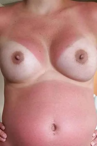 Nora Elnesvågen